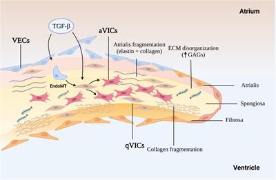 The Role of Transforming Growth Factor-β Signaling in Myxomatous Mitral Valve Degeneration